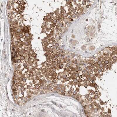 Immunohistochemistry-Paraffin: DOPEY1 Antibody [NBP1-90581]