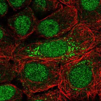 Immunocytochemistry/ Immunofluorescence: DOPEY2 Antibody [NBP2-58007]