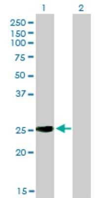 Western Blot: IGSF6/DORA Antibody (2A12) [H00010261-M01]