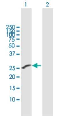 Western Blot: IGSF6/DORA Antibody [H00010261-B01P]