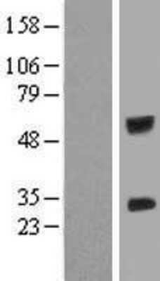 Western Blot: IGSF6/DORA Overexpression Lysate [NBL1-11884]