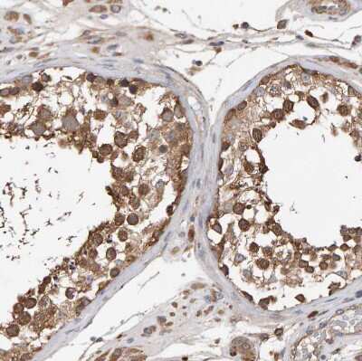 Immunohistochemistry-Paraffin: DORFIN Antibody [NBP1-87989]