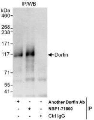 Immunoprecipitation: DORFIN Antibody [NBP1-71860]