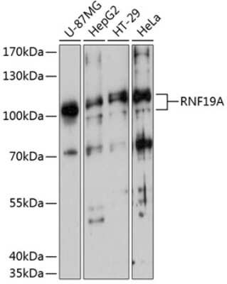 Western Blot: DORFIN AntibodyAzide and BSA Free [NBP2-92051]