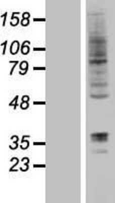 Western Blot: DORFIN Overexpression Lysate [NBL1-15441]