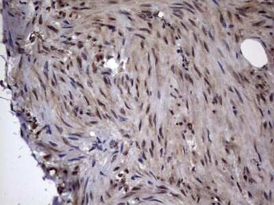 Immunohistochemistry: DOT1L Antibody (OTI1D8) [NBP2-46473]