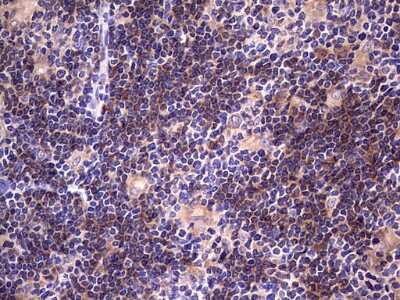 Immunohistochemistry: DOT1L Antibody (OTI1D8) [NBP2-46473]