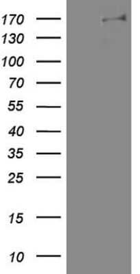 Western Blot: DOT1L Antibody (OTI1D8) [NBP2-46473]