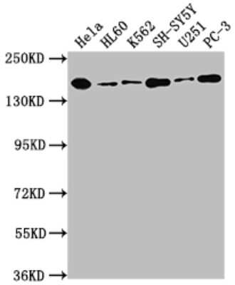 Western Blot: DOT1L Antibody (3B6) [NBP3-15150]