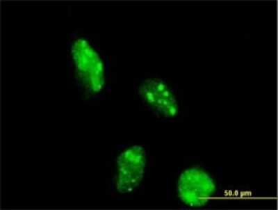 Immunocytochemistry/ Immunofluorescence: DOT1L Antibody (6A6) [H00084444-M01]