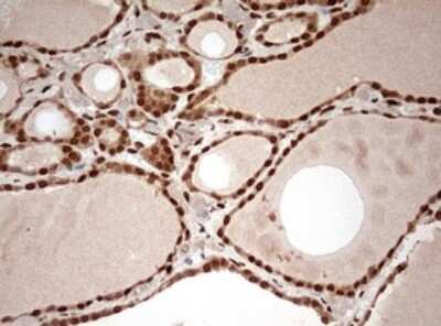 Immunohistochemistry: DOT1L Antibody (OTI6E7) [NBP2-46474]