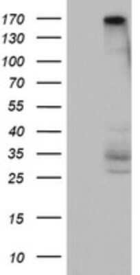 Western Blot: DOT1L Antibody (OTI6E7) [NBP2-46474]