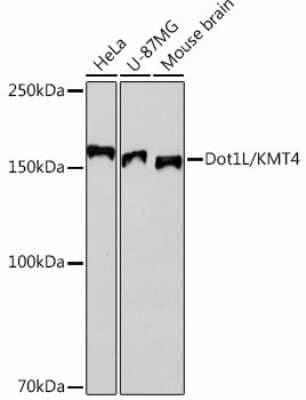 Western Blot: DOT1L Antibody (7A10H9) [NBP3-15446]