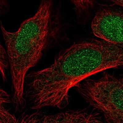 Immunocytochemistry/ Immunofluorescence: DOT1L Antibody [NBP2-55244]