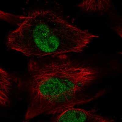Immunocytochemistry/ Immunofluorescence: DOT1L Antibody [NBP2-56641]