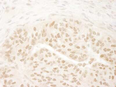 Immunohistochemistry-Paraffin: DOT1L Antibody [NB100-40845]