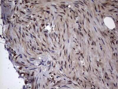 Immunohistochemistry: DOT1L Antibody (OTI1D8) - Azide and BSA Free [NBP2-72297]