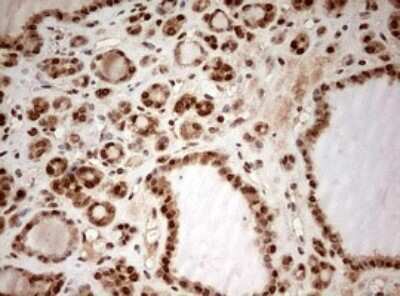 Immunohistochemistry: DOT1L Antibody (OTI6E7) - Azide and BSA Free [NBP2-72298]
