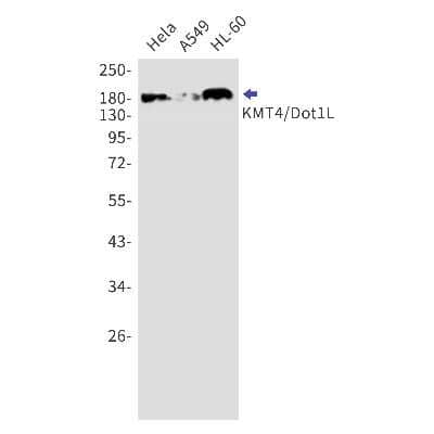 Western Blot: DOT1L Antibody (S01-7F6) [NBP3-15025]