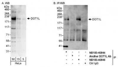 Western Blot: DOT1L Antibody [NB100-40845]