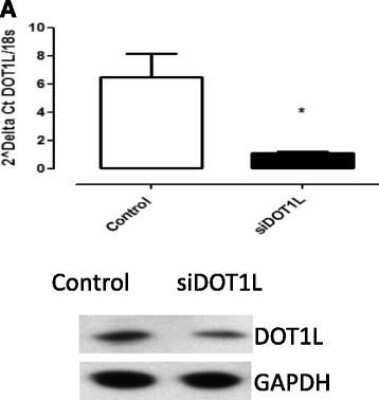 Western Blot: DOT1L Antibody [NB100-40845]