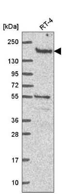 Western Blot: DOT1L Antibody [NBP2-56641]