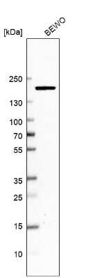 Western Blot: DOT1L Antibody [NBP2-56641]