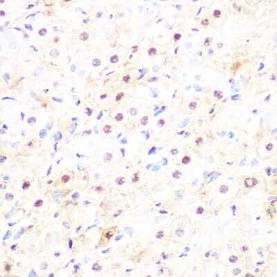 Immunohistochemistry-Paraffin: DP1 Antibody (8C0O3) [NBP3-16590]