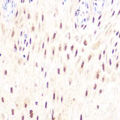 Immunohistochemistry-Paraffin: DP1 Antibody (8C0O3) [NBP3-16590]