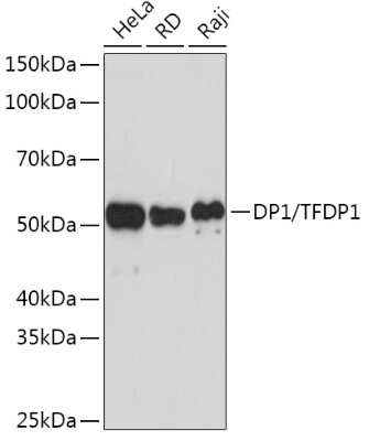 Western Blot: DP1 Antibody (8C0O3) [NBP3-16590]