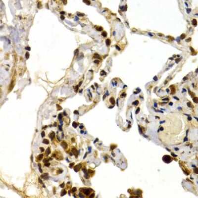 Immunohistochemistry-Paraffin: DP1 Antibody - Azide and BSA Free [NBP2-92787]