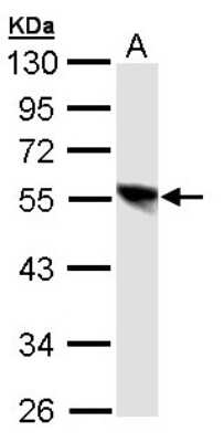 Western Blot: DP1 Antibody [NBP1-31880]