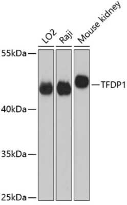 Western Blot: DP1 AntibodyAzide and BSA Free [NBP2-92787]