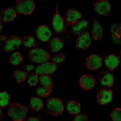 Immunocytochemistry/ Immunofluorescence: DP2 Antibody [NBP3-17703]