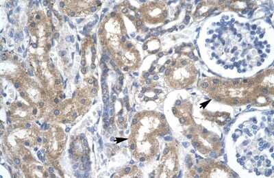 Immunohistochemistry: DP2 Antibody [NBP2-88806]