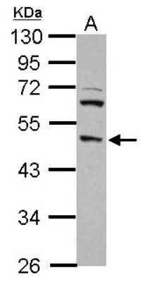 Western Blot: DP2 Antibody [NBP2-16216]