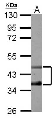 Western Blot: DP2 Antibody [NBP2-16216]