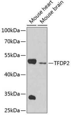 Western Blot: DP2 AntibodyBSA Free [NBP2-92440]