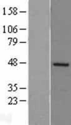 Western Blot: DP2 Overexpression Lysate [NBL1-16836]