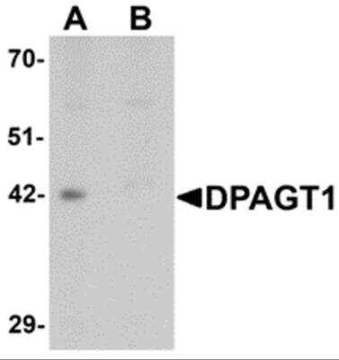 Western Blot: DPAGT1 AntibodyBSA Free [NBP2-81923]