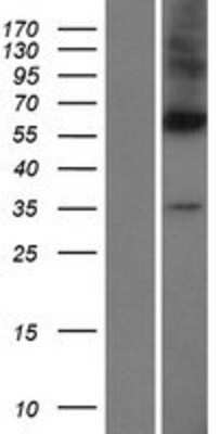 Western Blot: DPAGT1 Overexpression Lysate [NBL1-09985]