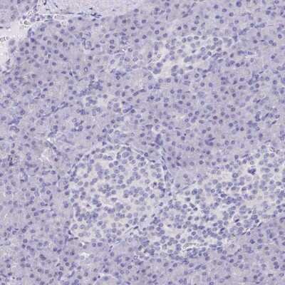 Immunohistochemistry-Paraffin: DPCR-1 Antibody [NBP1-89995]