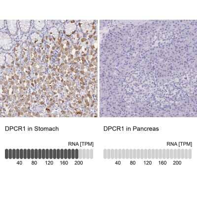 Immunohistochemistry-Paraffin: DPCR-1 Antibody [NBP1-89995]