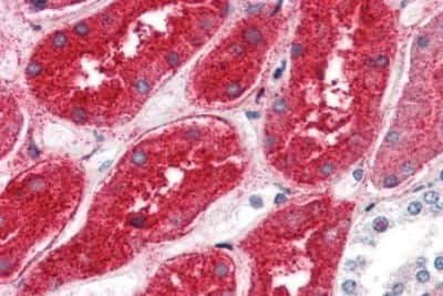 Immunohistochemistry-Paraffin: DPEP1 Antibody [NBP3-14299]