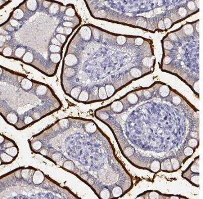 Immunohistochemistry-Paraffin: DPEP1 Antibody [NBP1-86115]