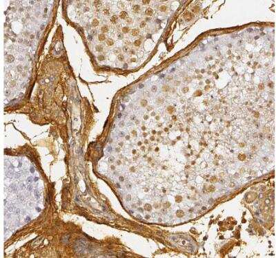 Immunohistochemistry-Paraffin: DPEP1 Antibody [NBP1-86115]