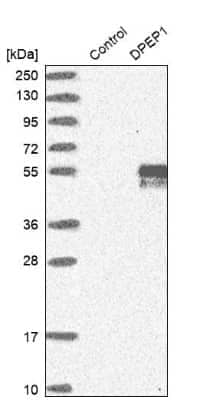 Western Blot: DPEP1 Antibody [NBP1-86087]