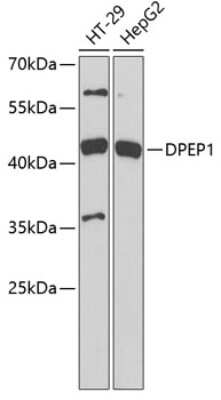 Western Blot: DPEP1 AntibodyBSA Free [NBP2-92470]