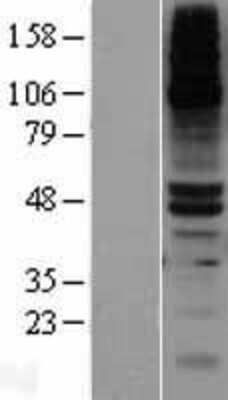 Western Blot: DPEP1 Overexpression Lysate [NBP2-09466]