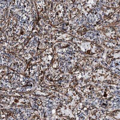 Immunohistochemistry-Paraffin: DPEP2 Antibody [NBP1-86304]